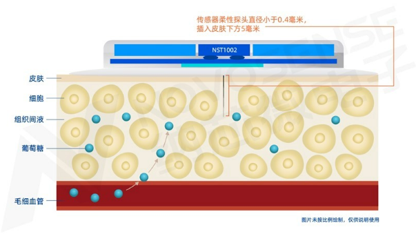 纳芯微NST1002助力CGM精准监测血糖