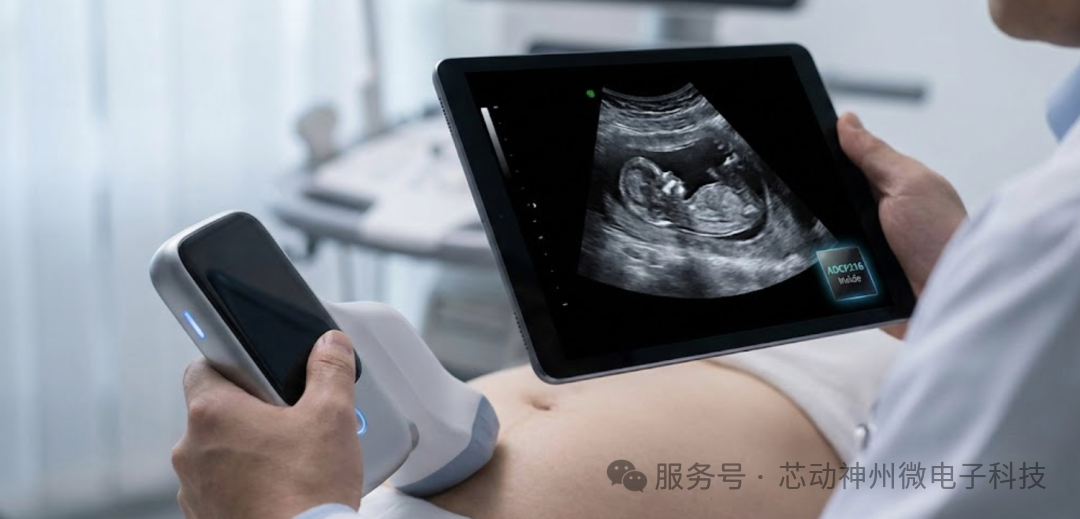医疗电子芯方案 | 让便携超声“看”得更清、用得更久：芯动神州ADCP216赋能高端医疗影像